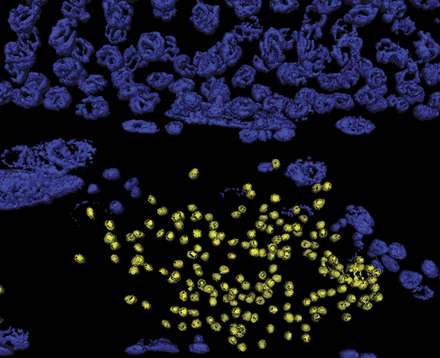 The hermaphroditic C. elegans germline generates sperm during larval development, followed by oogenesis in adulthood. This 3D rendering of germline chromatin includes a portion of the distal germline containing oogenic pachytene nuclei (top), as well as a portion of the proximal germline which stores the spermatids (yellow). Katherine McJunkin and Victor Ambros demonstrated that microRNAs act during embryogenesis to promote spermatogenesis and adult fecundity in C. elegans. Image courtesy of Katherine McJunkin. See McJunkin and Ambros, G3 4:1747–1754.