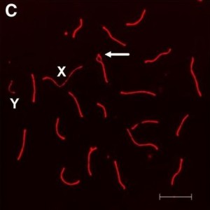 Chromosomes and aneuploidy