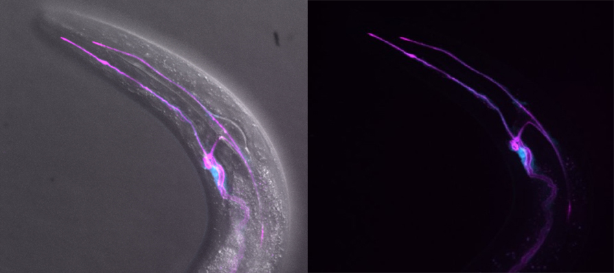 Excretory Cell. Image Courtesy of Daniel D. Shaye